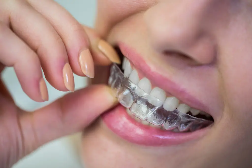 clear-aligners-or-metal-braces