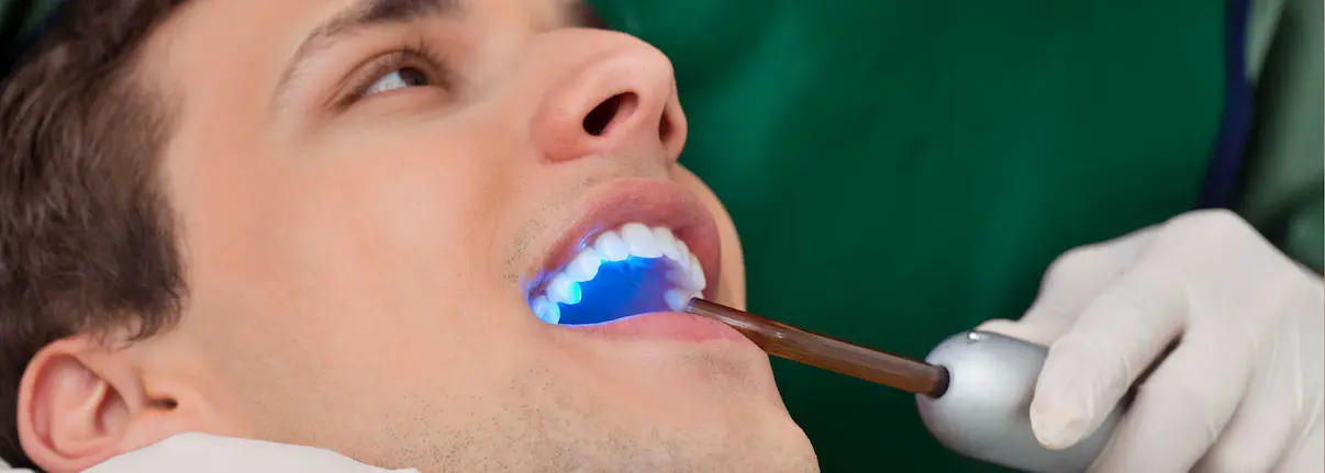 حفره‌ها و پوسیدگی دندان